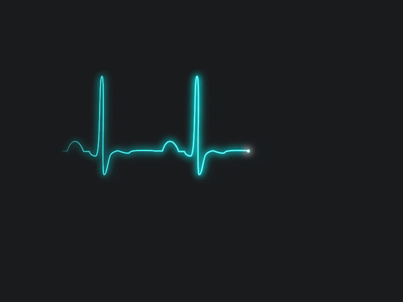 ecg